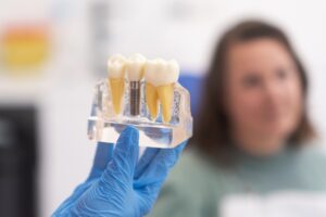 A gloved hand holds a transparent dental model displaying three teeth, one featuring a visible metal implant, with a blurred person in the background at a dentist's office.